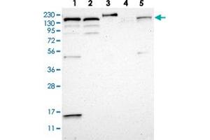 Western blot analysis of Lane 1: RT-4, Lane 2: U-251 MG, Lane 3: Human Plasma, Lane 4: Liver, Lane 5: Tonsil with FLII polyclonal antibody  at 1:250-1:500 dilution.