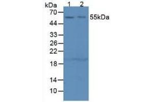 Figure. (SERPING1 anticorps  (AA 211-331))