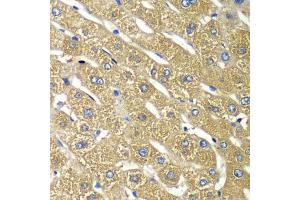 Immunohistochemistry of paraffin-embedded human liver injury using TMED10 Antibody (ABIN5974099) at dilution of 1/100 (40x lens). (TMED10 anticorps)