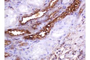 Image no. 3 for anti-Mucin 1 (MUC1) antibody (ABIN1499598)