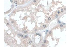 Detection of COQ6 in Human Kidney Tissue using Polyclonal Antibody to Coenzyme Q6 Homolog, Monooxygenase (COQ6)