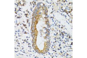 Immunohistochemistry of paraffin-embedded human vermiform appendix using SRP19 antibody (ABIN2560139) at dilution of 1:100 (40x lens). (SRP19 anticorps)