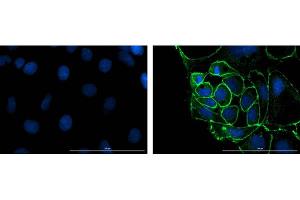Immunofluorescence microscopy using Fluorescent anti-rabbit IgG.