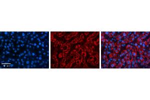 USE1 antibody - middle region          Formalin Fixed Paraffin Embedded Tissue:  Human Liver Tissue    Observed Staining:  Cytoplasm in hepatocytes   Primary Antibody Concentration:  1:100    Secondary Antibody:  Donkey anti-Rabbit-Cy3    Secondary Antibody Concentration:  1:200    Magnification:  20X    Exposure Time:  0.