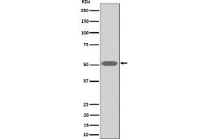 Western blot analysis of Thromboxane A2 receptor expression in human platelet cell lysate.