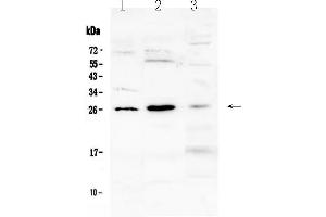 Western blot analysis of Flt3 ligand using anti-Flt3 ligand antibody . (FLT3LG anticorps  (AA 28-189))