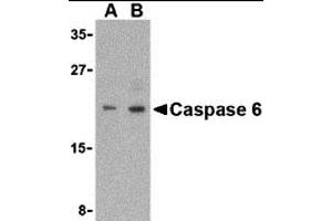 Western Blotting (WB) image for anti-Caspase 6, Apoptosis-Related Cysteine Peptidase (CASP6) (Middle Region) antibody (ABIN1030902) (Caspase 6 anticorps  (Middle Region))