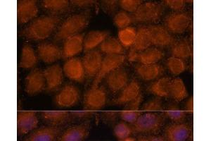Immunofluorescence analysis of HeLa cells using NDUFAF4 Polyclonal Antibody at dilution of 1:100.