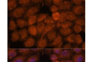 Immunofluorescence analysis of HeLa cells using NDUFAF4 Polyclonal Antibody at dilution of 1:100. (NDUFAF4 anticorps)