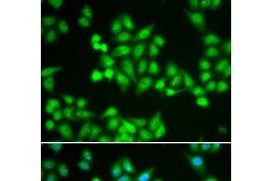 Immunofluorescence analysis of HeLa cells using CHD2 Polyclonal Antibody (CHD2 anticorps)
