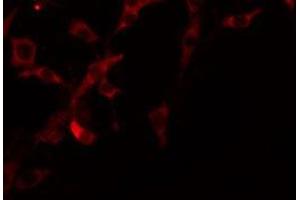 ABIN6275209 staining COLO205 by IF/ICC. (Lipase I anticorps  (Internal Region))