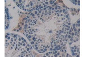 Detection of Flt3 in Mouse Testis Tissue using Polyclonal Antibody to FMS Like Tyrosine Kinase 3 (Flt3)