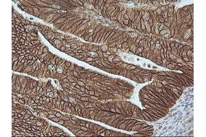 Image no. 5 for anti-Catenin (Cadherin-Associated Protein), beta 1, 88kDa (CTNNB1) antibody (ABIN1496898)