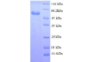 Vimentin (VIM) (AA 2-466) protein (His tag) expressed in E.