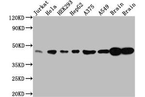 Western Blot Positive WB detected in: Jurkat whole cell lysate, Hela whole cell lysate, HEK293 whole cell lysate, HepG2 whole cell lysate, A375 whole cell lysate, A549 whole cell lysate, Rat Brain whole cell lysate, Mouse Brain whole cell lysate All lanes: ERK2 antibody at 1:1000 Secondary Goat polyclonal to rabbit IgG at 1/50000 dilution Predicted band size: 42, 37 kDa Observed band size: 42 kDa (Recombinant ERK2 anticorps)