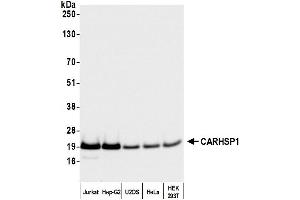 Western Blotting (WB) image for anti-Calcium Regulated Heat Stable Protein 1, 24kDa (CARHSP1) (AA 1-50) antibody (ABIN7449691)