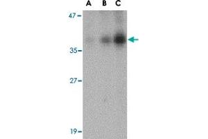 Western blot analysis of DFFB in Jurkat cell lysate with DFFB polyclonal antibody  at (A) 0.