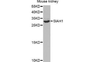 Western blot analysis of extracts of mouse kidney, using SIAH1 antibody (ABIN5971329) at 1/1000 dilution. (SIAH1 anticorps)