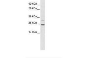 Image no. 1 for anti-DNA repair and recombination protein RAD54B (RAD54B) (AA 76-125) antibody (ABIN202190) (RAD54B anticorps  (AA 76-125))