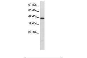 Image no. 1 for anti-HNF1 Homeobox B (HNF1B) (AA 43-92) antibody (ABIN202427) (HNF1B anticorps  (AA 43-92))
