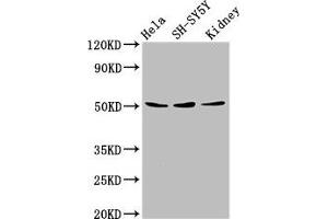 Western Blot Positive WB detected in: Hela whole cell lysate, SH-SY5Y whole cell lysate, Mouse kidney tissue All lanes: RARG antibody at 8 μg/mL Secondary Goat polyclonal to rabbit IgG at 1/50000 dilution Predicted band size: 51, 50, 43, 48 kDa Observed band size: 51 kDa (Retinoic Acid Receptor gamma anticorps  (AA 13-87))