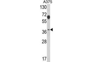 Western Blotting (WB) image for anti-Proteasome (Prosome, Macropain) 26S Subunit, Non-ATPase, 7 (PSMD7) antibody (ABIN3001710) (PSMD7 anticorps)
