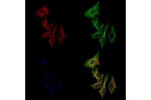 ABIN6258326 and ABIN6275198 staining 3 by IF/ICC. (Six5 anticorps  (C-Term))