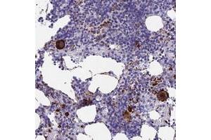 Immunohistochemical staining of human bone marrow with C15orf59 polyclonal antibody  shows strong cytoplasmic positivity in megakaryocytes at 1:500-1:1000 dilution. (C15ORF59 anticorps)