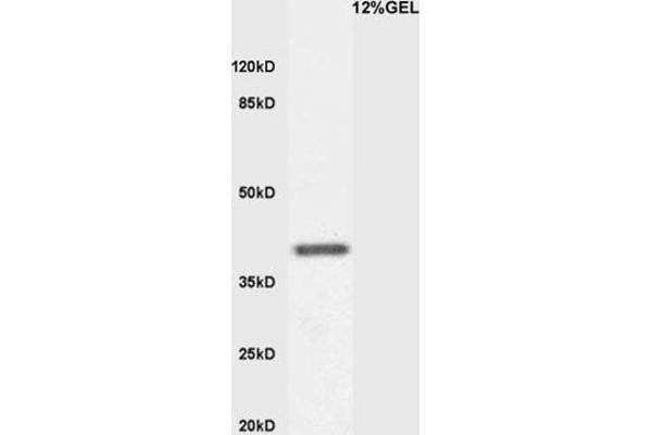 KLF2 anticorps  (AA 251-355)