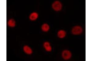 ABIN6275620 staining Hela by IF/ICC. (T-Box 18 anticorps  (Internal Region))