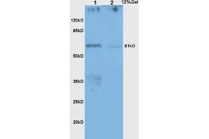 L1 human colon carcinoma lysates L2 human gastric carcinoma lysates probed with Anti CHK2 Polyclonal Antibody, Unconjugated (ABIN685867) at 1:200 in 4 °C.