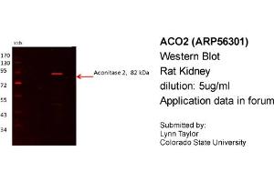 Western Blotting (WB) image for anti-Aconitase 2, Mitochondrial (ACO2) (N-Term) antibody (ABIN2786627) (ACO2 anticorps  (N-Term))