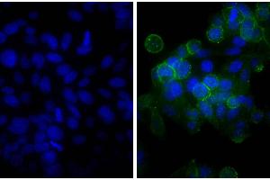Human epithelial carcinoma cell line HEp-2 was stained with Mouse Anti-Human CD44-UNLB, and DAPI.