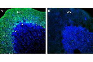 Expression of KCNT1 (Slack) in rat cerebellum.