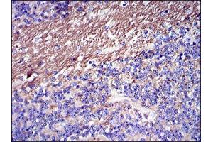 Immunohistochemical analysis of paraffin-embedded cerebellum tissues using FGG mouse mAb with DAB staining.
