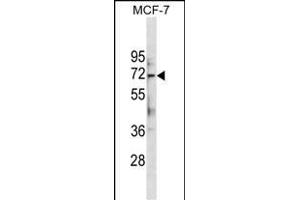 ATG13 Antibody (Center . (ATG13 anticorps  (AA 333-362))