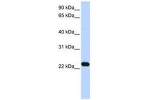 Image no. 1 for anti-Hepatitis B Virus X-Interacting Protein (HBXIP) (N-Term) antibody (ABIN6743628)