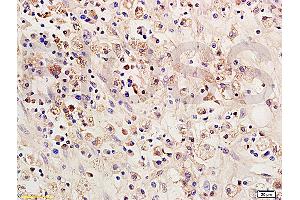 Formalin-fixed and paraffin embedded: rat brain tissue labeled with Anti-SOCS 1 Polyclonal Antibody (ABIN725135), Unconjugated 1:200 followed by conjugation to the secondary antibody and DAB staining (SOCS1 anticorps  (AA 121-211))