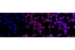 Immunocytochemical staining of C2C12 cells with PCK2 antibody (ABIN7799800), 1:1,000). (Recombinant PEPCK anticorps)