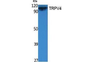 Western Blotting (WB) image for anti-Transient Receptor Potential Cation Channel, Subfamily V, Member 4 (TRPV4) (Internal Region) antibody (ABIN3178074) (TRPV4 anticorps  (Internal Region))