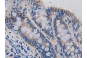 Detection of CDH16 in Mouse Intestine Tissue using Polyclonal Antibody to Cadherin 16 (CDH16)