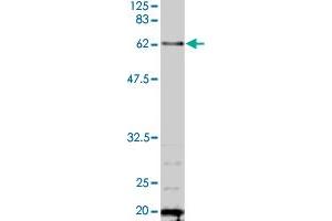 Detection of TAF6 by Western blotting using the TAF6 polyclonal antibody  . (TAF6 anticorps  (AA 1-200))