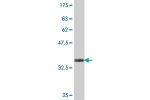 Western Blot detection against Immunogen (37.