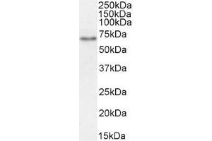 ABIN870680 (1µg/ml) staining of Rat Kidney lysate (35µg protein in RIPA buffer). (SLC5A1 anticorps  (Internal Region))