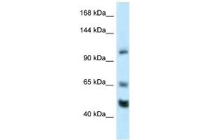 Western Blot showing Rest antibody used at a concentration of 1. (REST anticorps  (Middle Region))