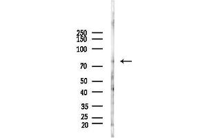 Western blot analysis of lysates from Rat testis, using MAP2 Antibody at 1/1000 dilution.