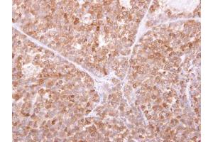 IHC-P Image GILT antibody detects IFI30 protein at cytosol on AGS xenograft by immunohistochemical analysis.