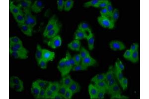 Immunofluorescence staining of HepG2 cells with ABIN7161089 at 1:100, counter-stained with DAPI. (SLC11A1 anticorps  (AA 1-58))
