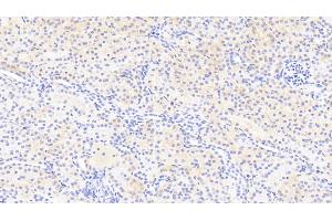 Detection of RGC32 in Human Kidney Tissue using Polyclonal Antibody to Response Gene To Complement 32 (RGC32)