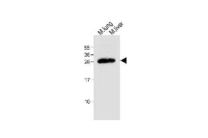 All lanes : Anti-Mouse Trem2 Antibody (N-term) at 1:500 dilution Lane 1: Mouse lung tissue lysate Lane 2: Mouse liver tissue lysate Lysates/proteins at 20 μg per lane. (TREM2 anticorps  (N-Term))